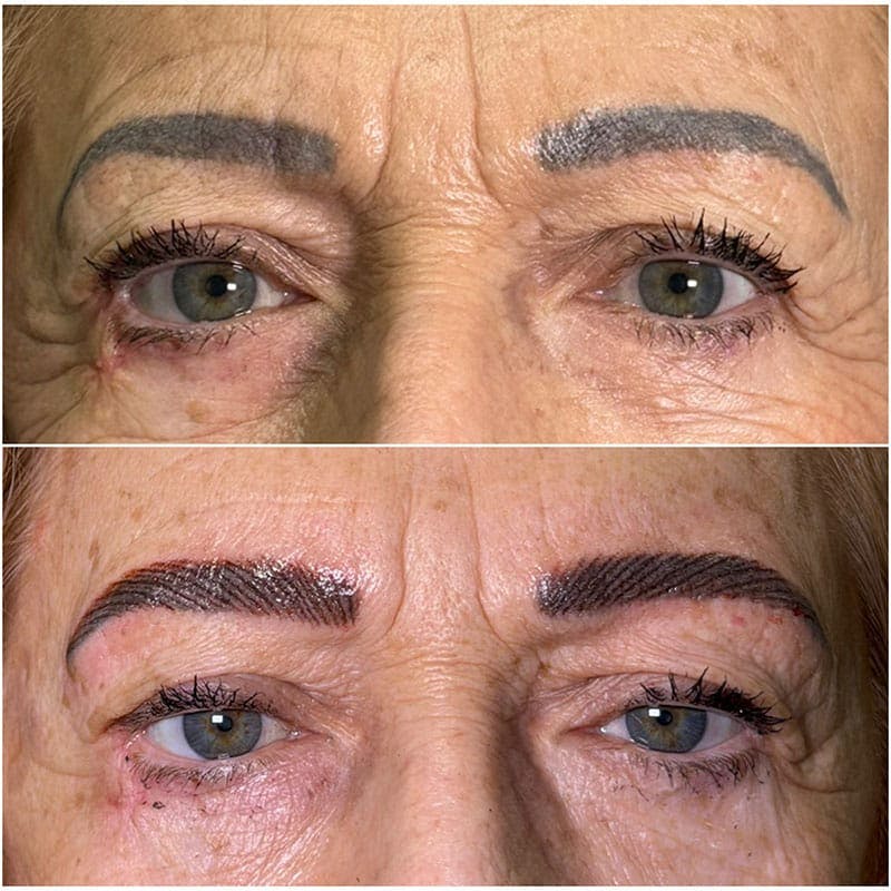 Microblading / Permanent Makeup Before & After Gallery - Patient 380978 - Image 1