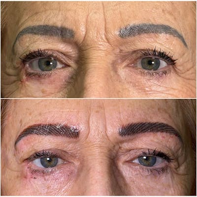 Microblading / Permanent Makeup Before & After Gallery - Patient 380978 - Image 1