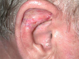 Face Reconstruction Before & After Gallery - Patient 167358262 - Image 2