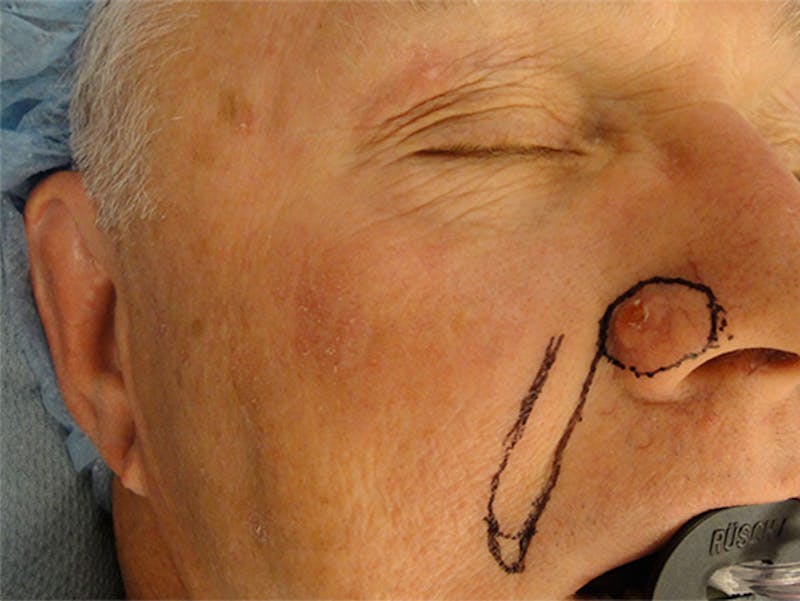 Face Reconstruction Before & After Gallery - Patient 167358279 - Image 3