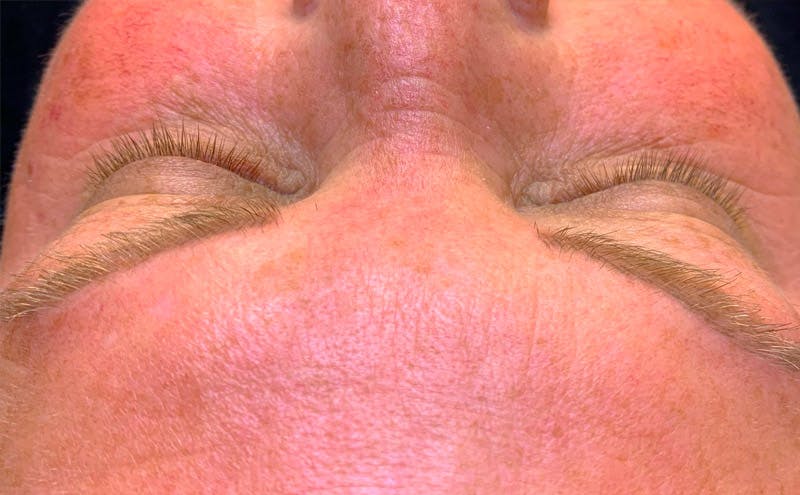 Microblading Before & After Gallery - Patient 167358286 - Image 1
