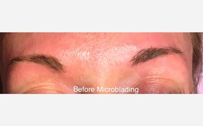 Microblading Before & After Gallery - Patient 167358293 - Image 1