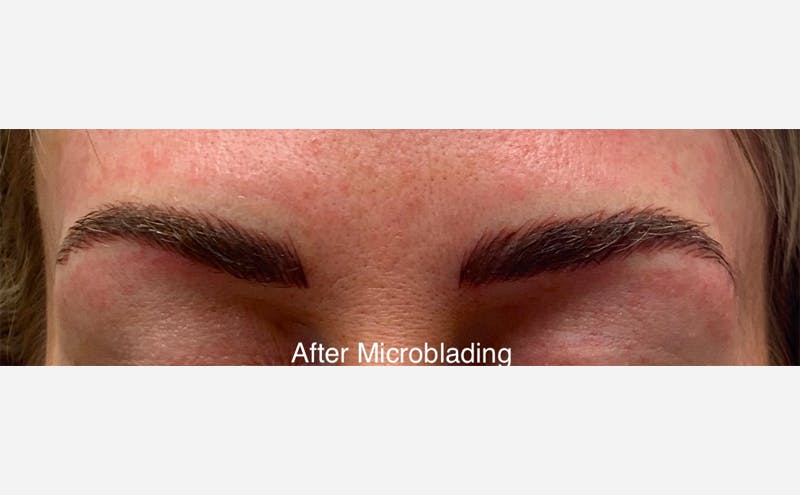 Microblading Before & After Gallery - Patient 167358293 - Image 2