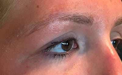 Microblading Before & After Gallery - Patient 167358299 - Image 1