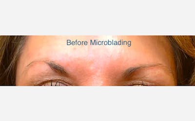 Microblading Before & After Gallery - Patient 167358303 - Image 1