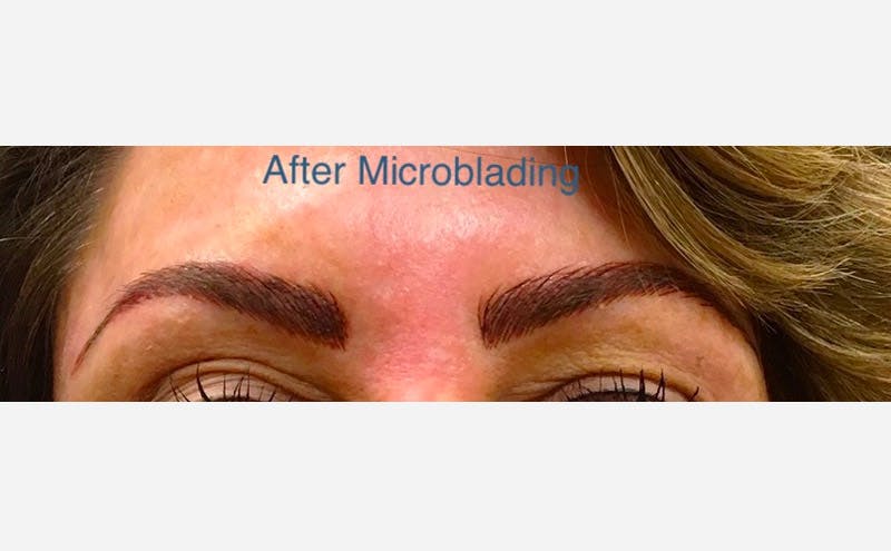 Microblading Before & After Gallery - Patient 167358303 - Image 2