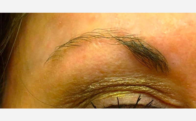 Microblading Before & After Gallery - Patient 167358310 - Image 1