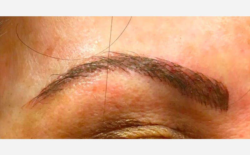 Microblading Before & After Gallery - Patient 167358310 - Image 2