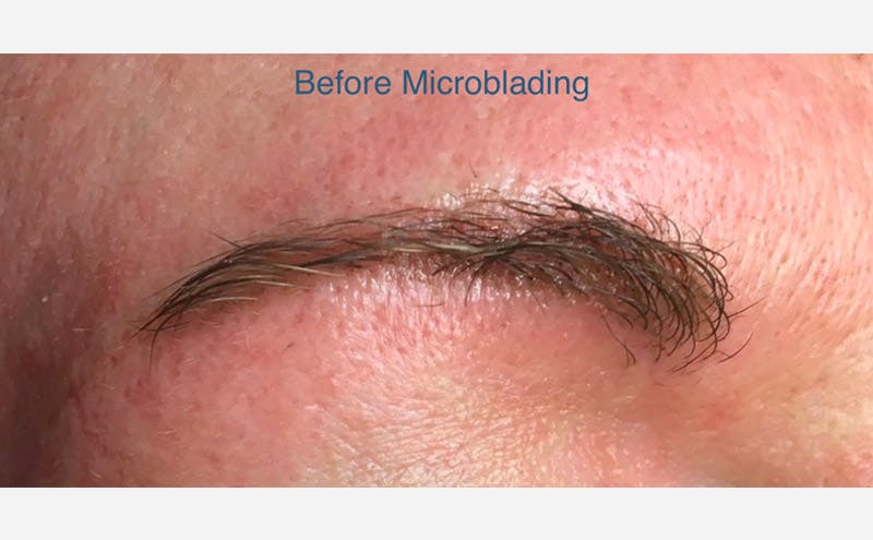 Microblading Before & After Gallery - Patient 167358322 - Image 1