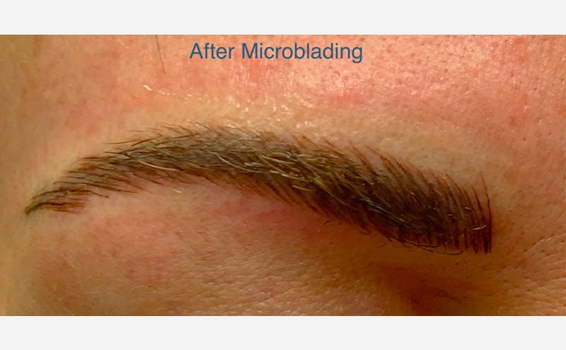 Microblading Before & After Gallery - Patient 167358322 - Image 2