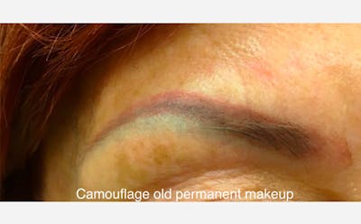 Microblading Before & After Gallery - Patient 167358352 - Image 1