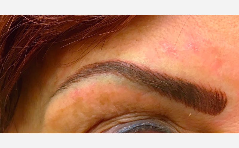 Microblading Before & After Gallery - Patient 167358352 - Image 2