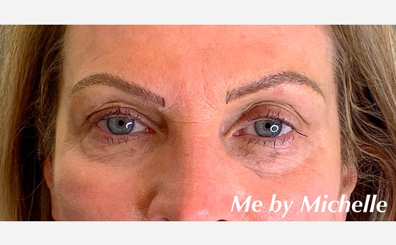 Microblading Before & After Gallery - Patient 167358359 - Image 2