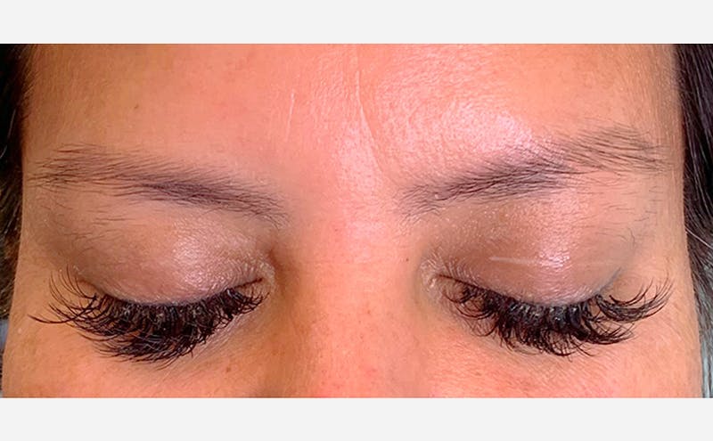 Microblading Before & After Gallery - Patient 167358363 - Image 1