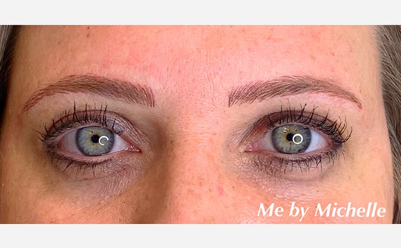 Microblading Before & After Gallery - Patient 167358372 - Image 2