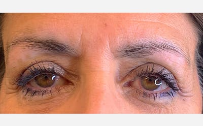 Microblading Before & After Gallery - Patient 167358387 - Image 1