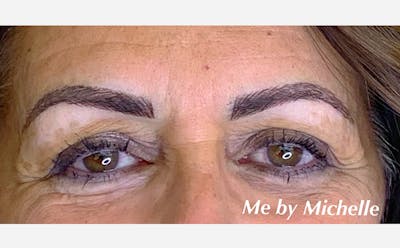 Microblading Before & After Gallery - Patient 167358387 - Image 2