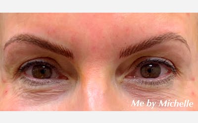 Microblading Before & After Gallery - Patient 167367513 - Image 2