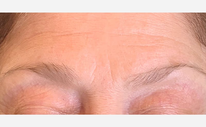 Microblading Before & After Gallery - Patient 167367518 - Image 1