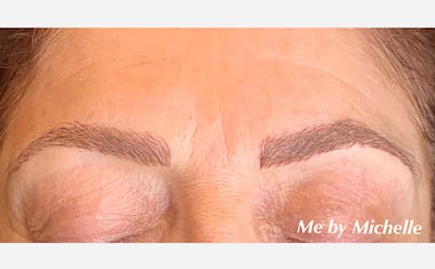 Microblading Before & After Gallery - Patient 167367518 - Image 2
