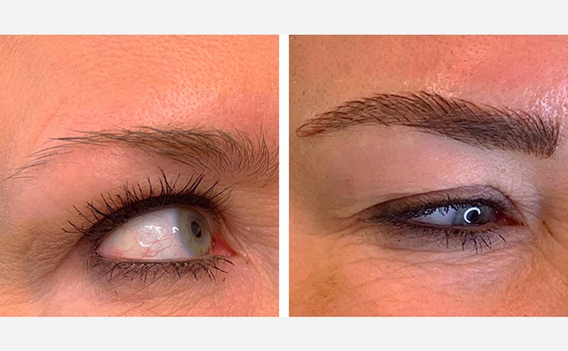 Microblading Before & After Gallery - Patient 167367522 - Image 1