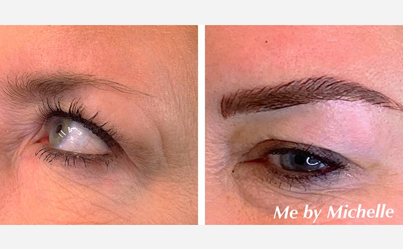Microblading Before & After Gallery - Patient 167367522 - Image 2