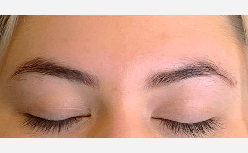 Microblading Before & After Gallery - Patient 167367540 - Image 1