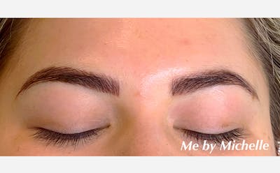 Microblading Before & After Gallery - Patient 167367540 - Image 2