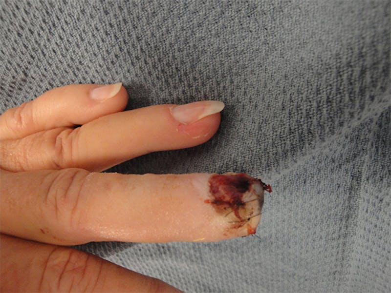 Reconstruction Before & After Gallery - Patient 167367544 - Image 3